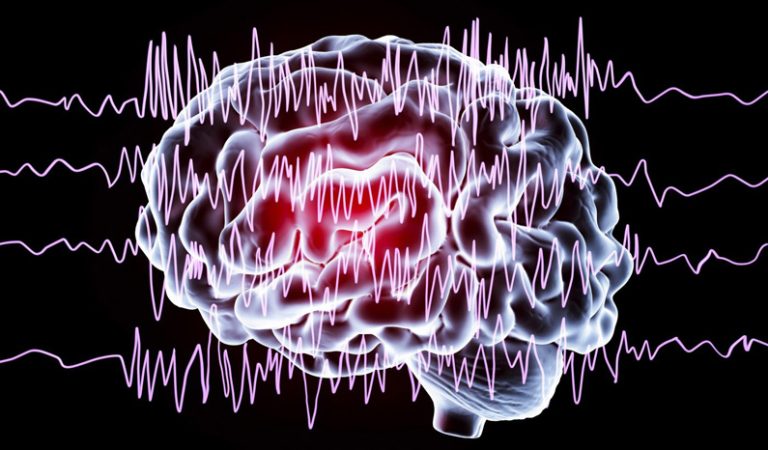 10 fakta du antagligen inte visste om epilepsi