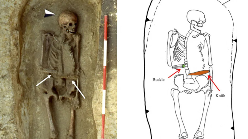 10 av de mest chockerande arkeologiska upptäckterna: Mannen med en kniv som arm.